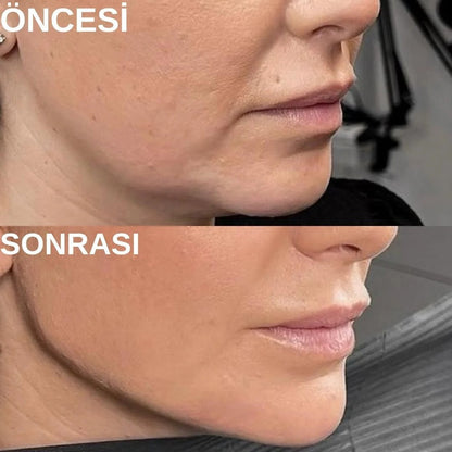 Kamessa™ Doğum Sonrası 4'lü Toparlayıcı Set